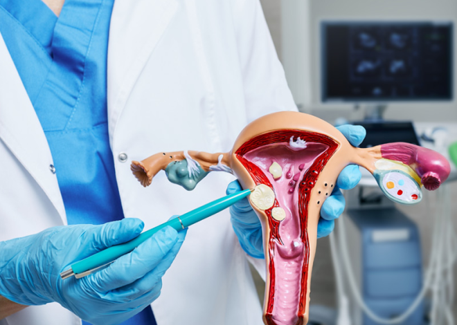 Menya byinshi ku ndwara ya Fibroids izahaza abagore ndetse ikaba yibasira abafite umubyibuho ukabije kandi ikaba ishobora gutera ubugumba uyirwaye