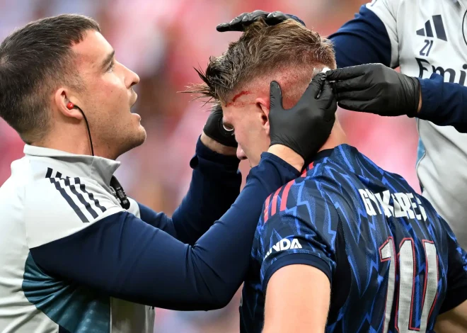 Mikel Arteta yakomoje ku mvune ya Viktor Gyokeres