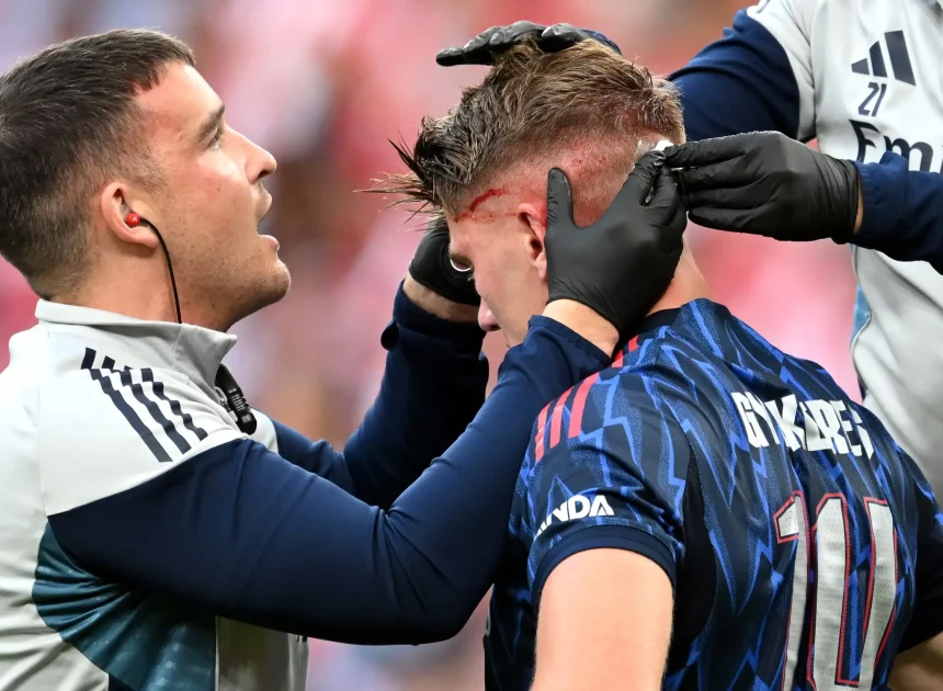 Mikel Arteta yakomoje ku mvune ya Viktor Gyokeres