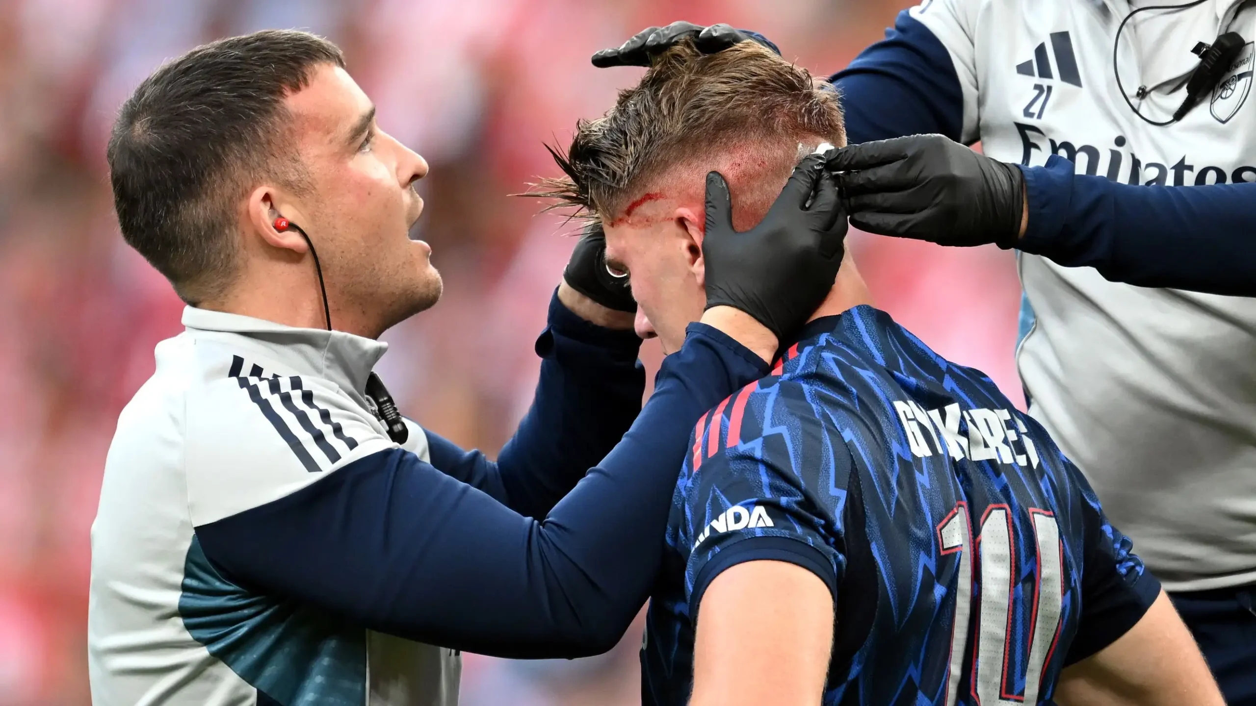 Mikel Arteta yakomoje ku mvune ya Viktor Gyokeres