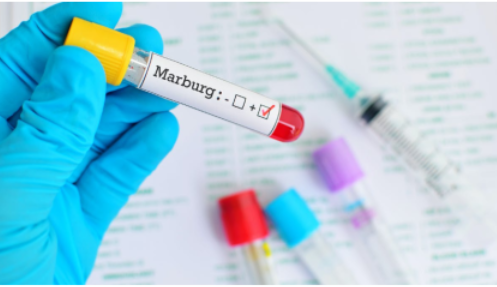 Ethiopia Yongeye Kugarizwa N’icyorezo Cya Marburg